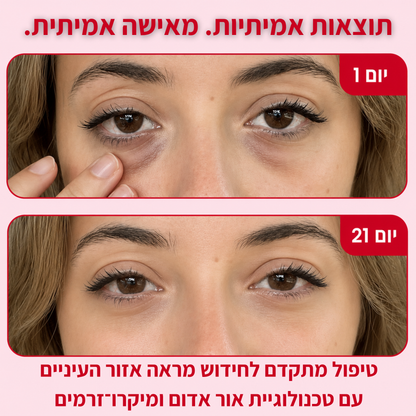 נראית עייפה גם כשישנת מספיק? ™GlowixEye מחזיר לעיניים מבט ער — בלי העיגולים ובלי הנפיחות.