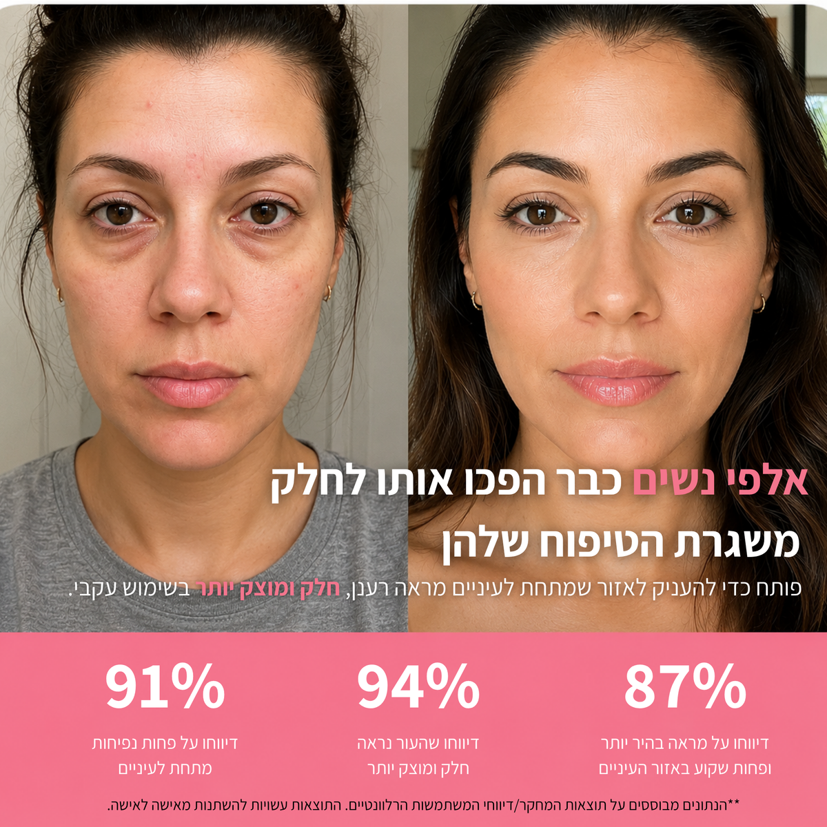 נראית עייפה גם כשישנת מספיק? ™GlowixEye מחזיר לעיניים מבט ער — בלי העיגולים ובלי הנפיחות.